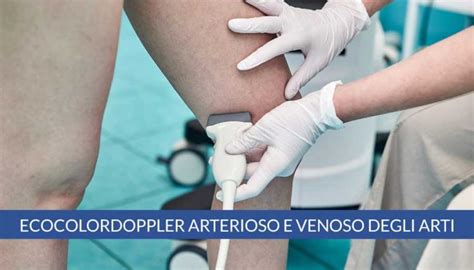 Ecocolordoppler venoso degli arti inferiori