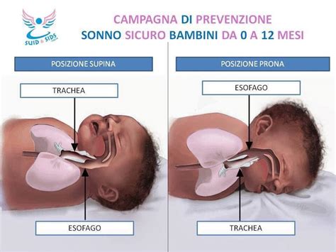 Schema che illustra la posizione supina sicura per il sonno del neonato