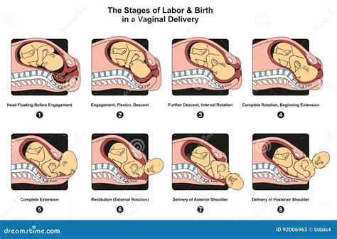 Schematic representation of the stages of labor