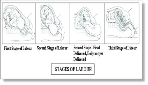 Diagram illustrating the three stages of labor and delivery
