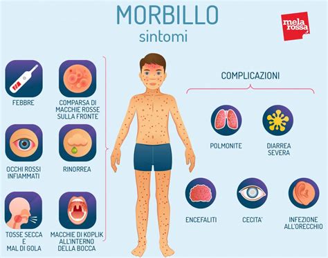Morbillo, Rosolia e Varicella: Impatto sulla Gravidanza