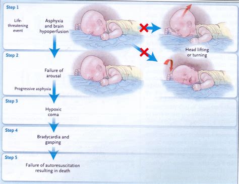 Sindrome della Morte Improvvisa del Lattante (SIDS): Statistiche e Falsi Miti