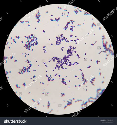 Microscopic view of Group A Streptococcus