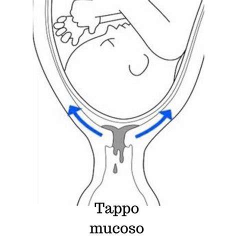 Domande frequenti tappo mucoso
