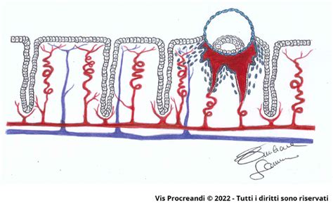 Schema semplificato della placenta e delle arterie spirali uterine