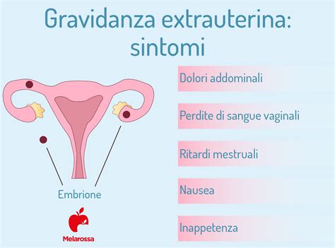 Localizzazioni Comuni e Rare della Gravidanza Extrauterina