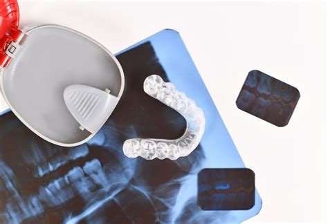 rappresentazione grafica di un bite dentale personalizzato in resina acrilica