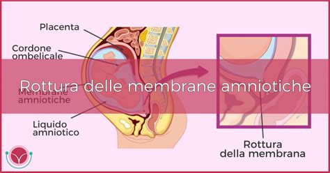 Immagine che illustra le membrane amniotiche che circondano il feto in utero.