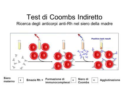 Illustrazione schematica del processo del test di Coombs indiretto