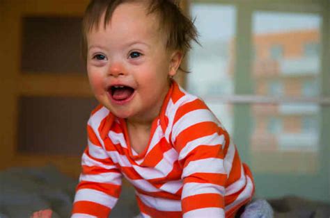 Facies tipica di un bambino con Sindrome di Down
