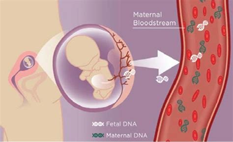DNA fetale circolante nel sangue materno