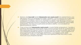 Tipologie di contenziosi medico-legali in ostetricia
