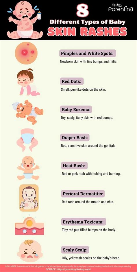 Baby skin irritation
