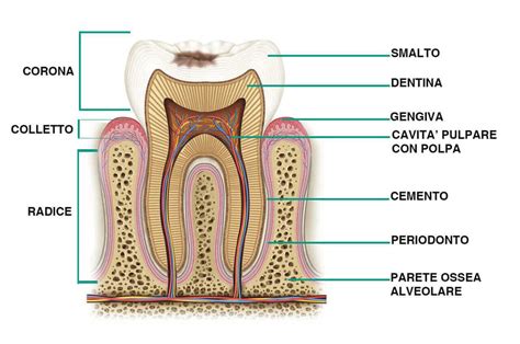 schema di un dente sano e un dente cariato