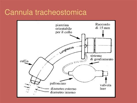 schema anatomico della posizione corretta di una cannula tracheostomica nella trachea