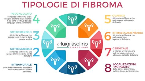 Diagramma che mostra la posizione dei fibromi uterini (subserosi, intramurali, sottomucosi)