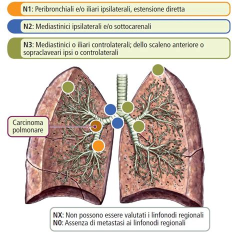 tavola illustrativa sulle docimasie polmonari nell'autopsia neonatale