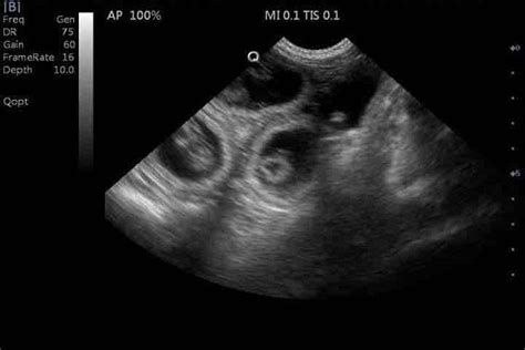 Ecografia di una cagna in gravidanza