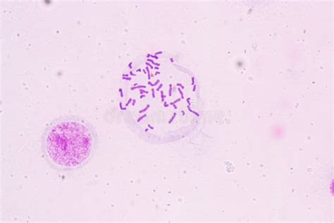 Cromosomi umani al microscopio
