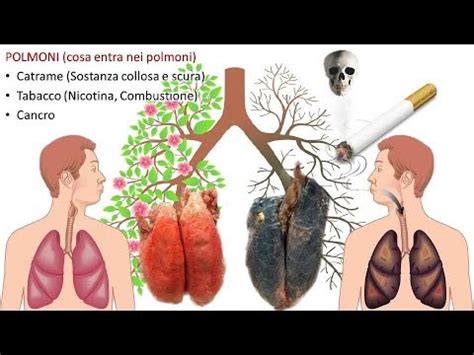 Differenza tra polmone sano e polmone con insufficienza respiratoria