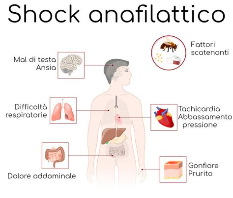 Diagramma che illustra i sintomi dello shock anafilattico