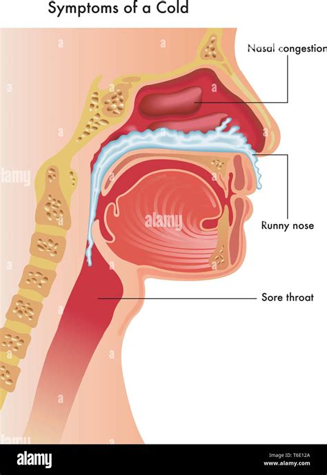 Diagramma del tratto respiratorio superiore di un bambino