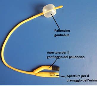 Catetere di Foley per induzione