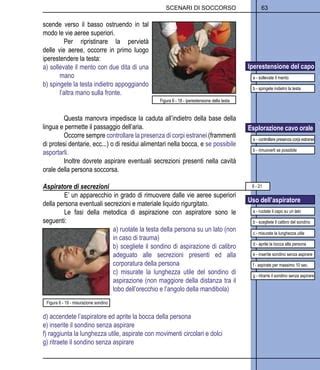 confronto visivo tra aspiratore a bulbo e aspiratore manuale a bocca