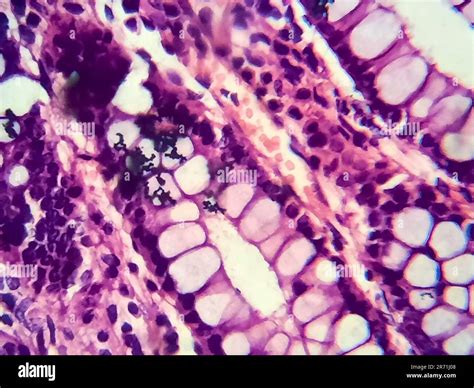 Microscopio che mostra batteri vaginali