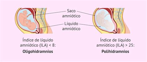 Diagramma dell'utero gravido con feto e liquido amniotico
