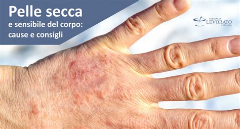 Pelle secca e arrossata