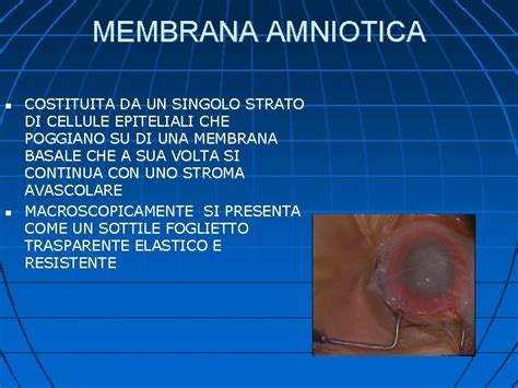 Utilizzo terapeutico della membrana amniotica
