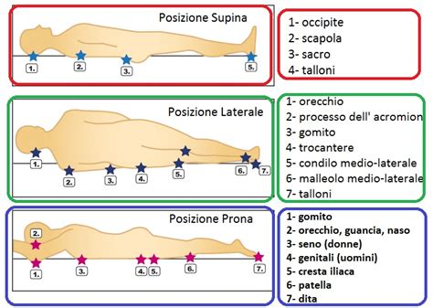 Diagramma formazione piaga da decubito