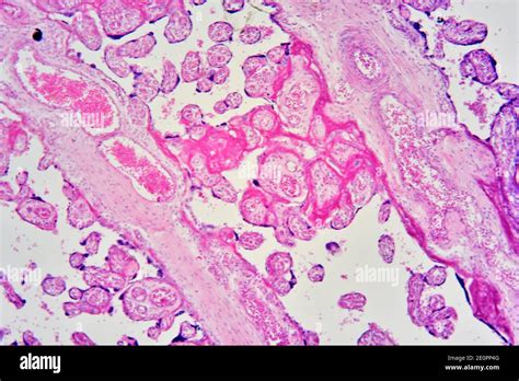 dettaglio microscopico dei villi coriali