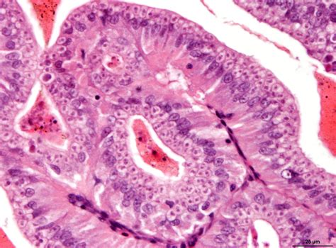 Illustrazione microscopica di Hoferellus carassii.