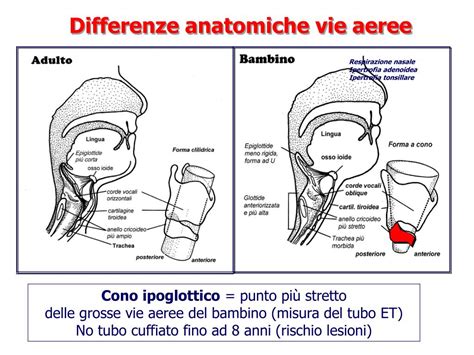 Diagramma delle vie aeree di un bambino