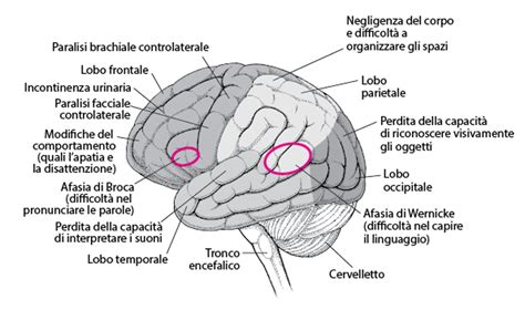 Danni al cervello da ipossia
