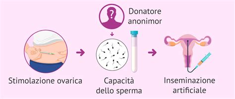Donne che si sottopongono a inseminazione artificiale