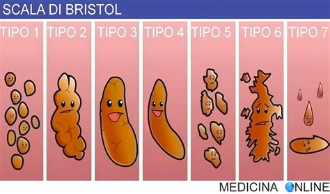 Tabella comparativa feci normali vs. diarroiche nel neonato