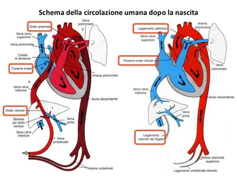 Diagramma di un cuore fetale con difetto congenito