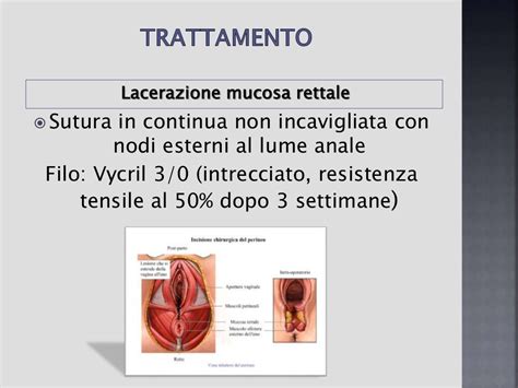 Lacerazioni perineali durante il parto