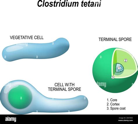 Schema che illustra l'ingresso delle spore di Clostridium tetani attraverso una ferita e l'azione della tossina