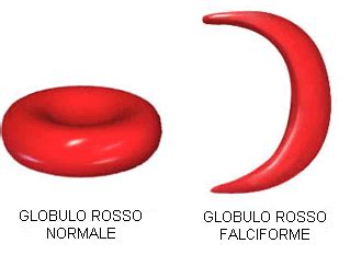 Globuli rossi a forma di falce