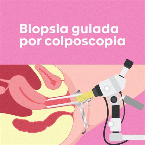 Vaginoscopia/Colposcopia