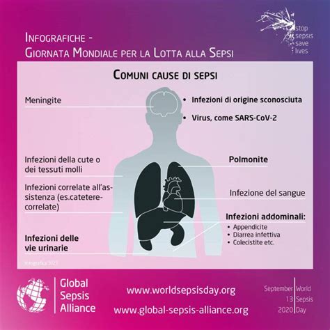 infografica sulle cause principali della splenomegalia