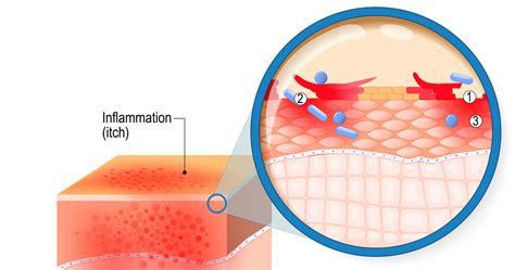 Diagramma sul processo di riparazione della barriera cutanea