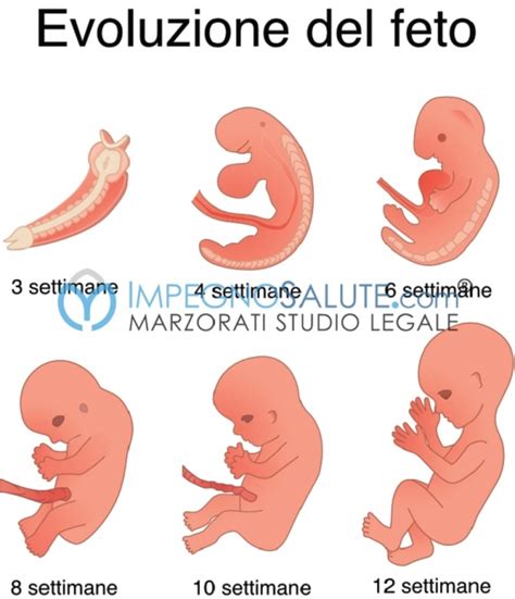 Schema del primo trimestre di gravidanza con sacco amniotico e coriale