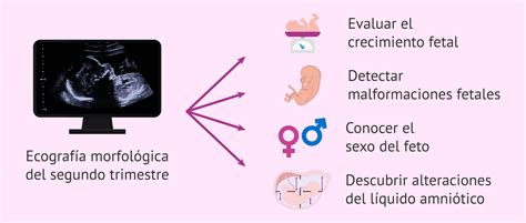 Ecografia morfologica del feto