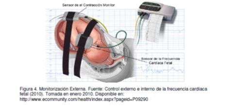 Monitoraggio cardiotocografico in un ambiente ostetrico moderno