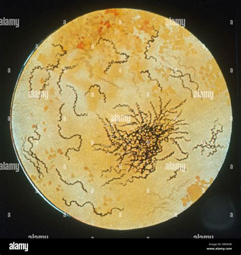 Microscopio elettronico di Treponema pallidum